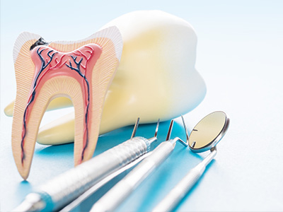 Anatomical model of a tooth with a toothbrush, dental tools, and a dental implant in the background.